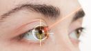 Cirugias de cambio de color de ojos: qué dicen los médicos